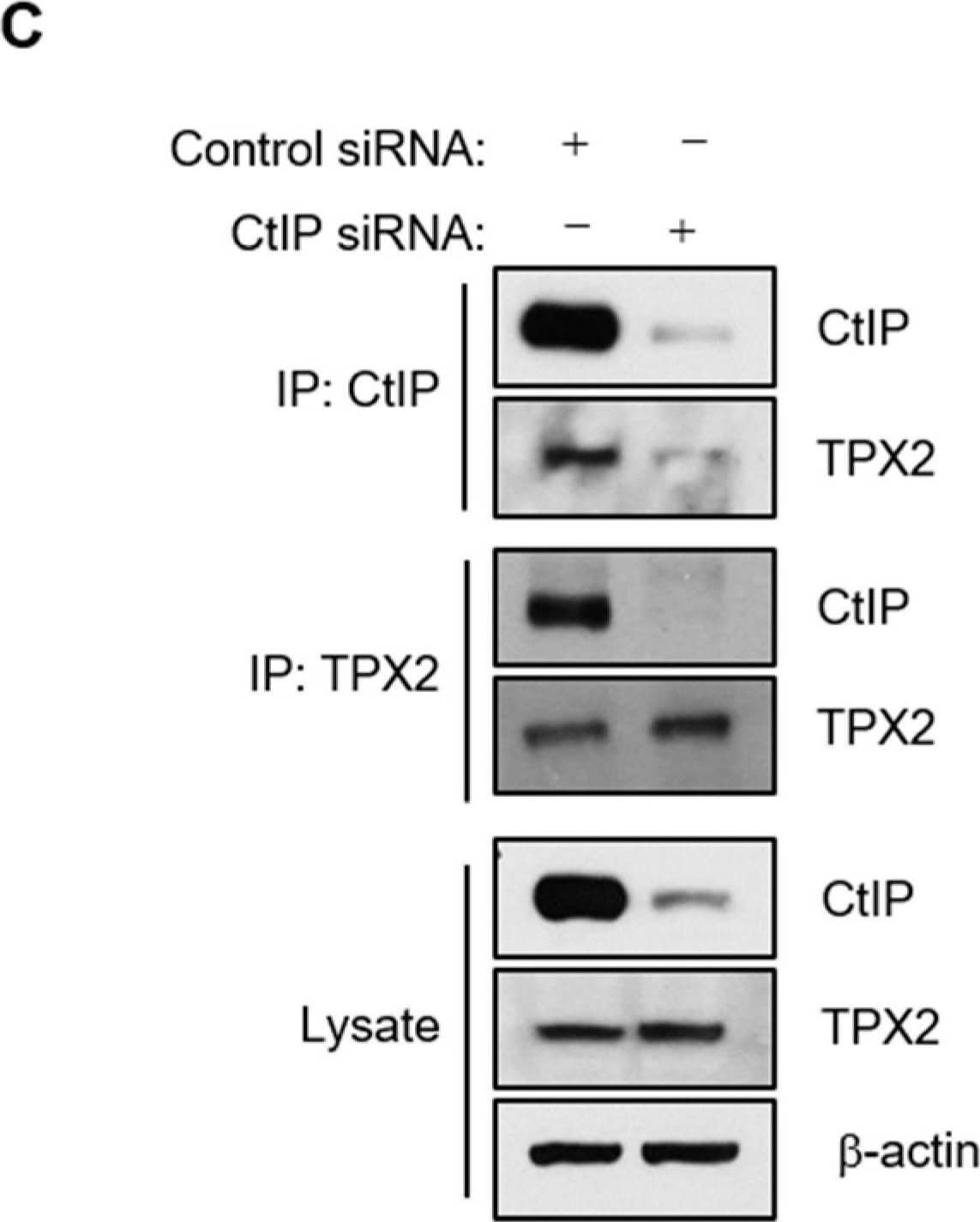 CtIP interacts with TPX2. (A,B) CtIP coimmunoprecipitates with TPX2. Total cell lysates (1 mg) from HEK293T cells transfected with Flag-tagged full length CtIP and HA-tagged full length TPX2 were immunoprecipitated with anti-Flag (A) or anti-HA (B) antibodies. Immunoblotting was then performed with the indicated antibodies. (C) Total cell lysates from HEK293T cells transfected with control siRNA and CtIP siRNA were immunoprecipitated with anti-CtIP or anti-TPX2 antibodies. Immunoblotting was then performed with the indicated antibodies. (D) The cellular localization of CtIP and TPX2 during mitosis was monitored using Immunofluorescence microcopy. Asynchronous HeLa cells were fixed and stained with anti-CtIP and anti-TPX2 antibodies. Representative images show that CtIP colocalizes with TPX2 at the kinetochore from prometaphase through anaphase. Image collected and cropped by CiteAb from the following open publication (//www.mdpi.com/2073-4409/11/18/2814), licensed under a CC-BY license. Not internally tested by Novus Biologicals.