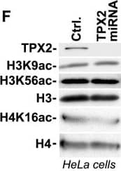 Western Blot: TPX2 Antibody [NB500-184] - TPX2 is constitutively associated with chromatin & impacts the DAPI staining pattern & H4K16ac levels.(A) Although the majority of TPX2 is found in the soluble fraction (see Material & Methods), a small but clearly detectable sub-population of TPX2 constitutively associates with stringent chromatin fractions obtained from MCF7 cells (left panel) or HeLa cells (right panel). These chromatin fractions contain histones but not nuclear LaminB. Upon expression of an inducible TPX2 targeting miRNA (or upon transfection with siRNA; see D) the protein was depleted from chromatin fractions. Ctrl: control cells with no induction of TPX2 miRNA. (B) TPX2 gets enriched in chromatin fractions isolated from HeLa cells after treatment with 10 Gy of ionizing radiation. Note the constitutive association of TPX2 with the chromatin in non-irradiated cells. Levels of H2AX were used as a loading control. (C) Overexpression of GFP-TPX2 or His-TPX2 causes abnormal DAPI staining in MCF7 cells compared to surrounding non-transfected cells or cells transfected with GFP. This is indicative of changes in chromatin structure. Enlargements of white frames are shown. In agreement with previous reports, overexpressed TPX2 is mostly found in the nucleus but also associates with the cytoskeleton [2]. (D-F) Depletion of TPX2 by siRNA (D) or miRNA (F) causes a decrease in H4K16ac levels whereas the levels of H3K9ac & H3K56ac remain unchanged. (E) Quantification of H3K9ac & H3K56ac levels from MCF7 cells transfected with control or TPX2 siRNA (n = 4 independent experiments each; p(t test)>0.05; NS: non significant; Error bars represent SE). Stripping of western blots & re-development with antibodies specific for H3 & H4 ensured equal loading. See text for details. Image collected & cropped by CiteAb from the following publication (//dx.plos.org/10.1371/journal.pone.0110994), licensed under a CC-BY license. Not internally tested by Novus Biologicals.