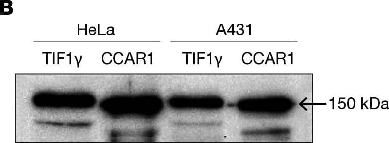 Western Blot: CCAR1 Antibody [NB500-186] - Autoantibody discovery in anti–TIF1-gamma –positive DM patients without cancer.(A) Immunoprecipitations (IPs) were performed using lysates made from radiolabeled cells & plasma from anti–TIF1-gamma –positive DM patients, 5 of whom did not have a cancer, & 5 of whom had a detected cancer. An IP performed with a sample from a healthy control (HC) individual is shown in the right-most lane. Migration of molecular weight standards is marked on the left. (B) Immunoblotted lysates. Lysates made from HeLa & A431 cells were immunoblotted with commercial antibodies against TIF1-gamma  & CCAR1, as described in the Methods section. Both proteins migrate at approximately 150 kDa. (C) Interaction between CCAR1 & TIF1-gamma . Co-IPs were performed as described in the Methods section, using antibodies against CCAR1 (upper panel, 2 left lanes) or TIF1-gamma  (lower panel, 2 left lanes). Detection of the IPs was performed by immunoblotting with anti–TIF1-gamma  (upper panel, 2 left lanes) or anti-CCAR1 (lower panel, 2 left lanes) antibodies. Control IPs, performed using Protein A beads only, were performed & immunoblotted as above. IPs were performed in duplicate. These data are representative of those obtained in 2 additional experiments. Image collected & cropped by CiteAb from the following publication (//pubmed.ncbi.nlm.nih.gov/35040440), licensed under a CC-BY license. Not internally tested by Novus Biologicals.