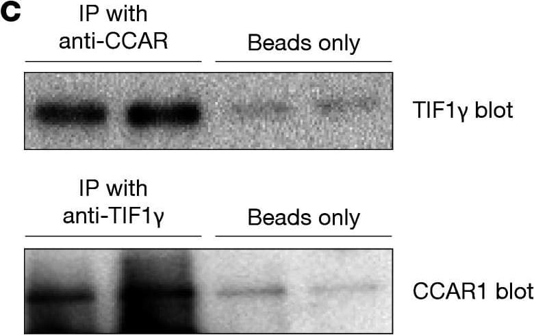 Western Blot: CCAR1 Antibody [NB500-186] - Autoantibody discovery in anti–TIF1-gamma –positive DM patients without cancer.(A) Immunoprecipitations (IPs) were performed using lysates made from radiolabeled cells & plasma from anti–TIF1-gamma –positive DM patients, 5 of whom did not have a cancer, & 5 of whom had a detected cancer. An IP performed with a sample from a healthy control (HC) individual is shown in the right-most lane. Migration of molecular weight standards is marked on the left. (B) Immunoblotted lysates. Lysates made from HeLa & A431 cells were immunoblotted with commercial antibodies against TIF1-gamma  & CCAR1, as described in the Methods section. Both proteins migrate at approximately 150 kDa. (C) Interaction between CCAR1 & TIF1-gamma . Co-IPs were performed as described in the Methods section, using antibodies against CCAR1 (upper panel, 2 left lanes) or TIF1-gamma  (lower panel, 2 left lanes). Detection of the IPs was performed by immunoblotting with anti–TIF1-gamma  (upper panel, 2 left lanes) or anti-CCAR1 (lower panel, 2 left lanes) antibodies. Control IPs, performed using Protein A beads only, were performed & immunoblotted as above. IPs were performed in duplicate. These data are representative of those obtained in 2 additional experiments. Image collected & cropped by CiteAb from the following publication (//pubmed.ncbi.nlm.nih.gov/35040440), licensed under a CC-BY license. Not internally tested by Novus Biologicals.