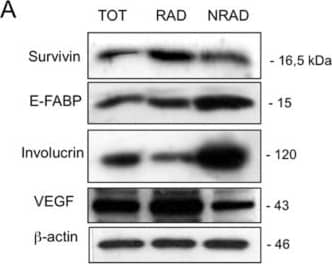Western Blot: Survivin Antibody - BSA Free [NB500-201] - Expression of stem cell & differentiation markers in RAD, NRAD & TOT cells from cSCC. (A) Cells were analyzed immediately after separation, & levels of markers were determined by Western blot analysis.  beta -actin was used as loading control; (B) Bar graphs show the average densitometry values normalized to actin. *p < 0.05; **p < 0.01. Image collected & cropped by CiteAb from the following publication (//www.mdpi.com/1422-0067/14/10/19540), licensed under a CC-BY license. Not internally tested by Novus Biologicals.