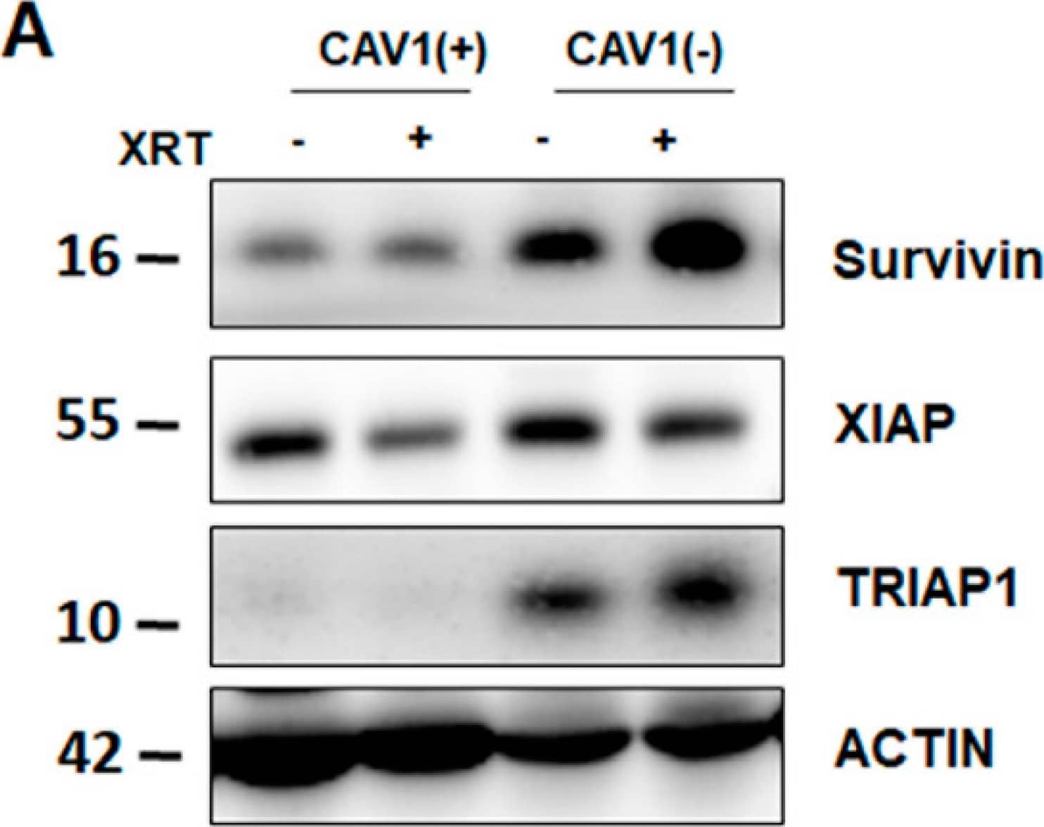 Western Blot: Survivin Antibody - BSA Free [NB500-201] - Radiation-resistant Caveolin-1 (CAV1)-silenced fibroblasts differentially express & secrete the apoptosis inhibiting protein TP53-regulated inhibitor of apoptosis 1 (TRIAP1). Image collected & cropped by CiteAb from the following publication (//pubmed.ncbi.nlm.nih.gov/30871022), licensed under a CC-BY license. Not internally tested by Novus Biologicals.