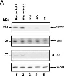 Western Blot: Survivin Antibody - BSA Free [NB500-201] - Gene-silencing of Bcl-2, Survivin & XIAP. Western blot showed efficient silencing in transfected MiaPaCa-2 (A) & AsPC-1 cells (B). 50,000 cells/well were single-transfected with carrier solution (lane 1) & siRNA against Luciferase (lane 2) as control. SGS, lowST & ST all effectively silenced the three target genes (lane 3-5). Efficient knock-down was also shown in the lowST group by RT-PCR in MiaPaCa-2 (C) & AsPC-1 cells (D). White bars show controls, grey bars signify transfected cells. All samples were normalized to  beta -Actin as a house-keeping gene. SGS = Simultaneous gene silencing; lowST = Low dose siRNA transfection; ST = Standard dose siRNA transfection. Image collected & cropped by CiteAb from the following publication (//pubmed.ncbi.nlm.nih.gov/20646298), licensed under a CC-BY license. Not internally tested by Novus Biologicals.