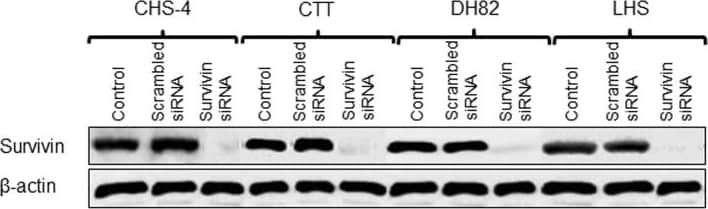 Western Blot: Survivin Antibody - BSA Free [NB500-201] - Expression of survivin protein in cell lines after transfection with siRNA.Survivin protein expression in CHS cell lines was evaluated by western blotting at 48 h after transfection with scrambled & survivin siRNA. Image collected & cropped by CiteAb from the following publication (//pubmed.ncbi.nlm.nih.gov/24260303), licensed under a CC-BY license. Not internally tested by Novus Biologicals.