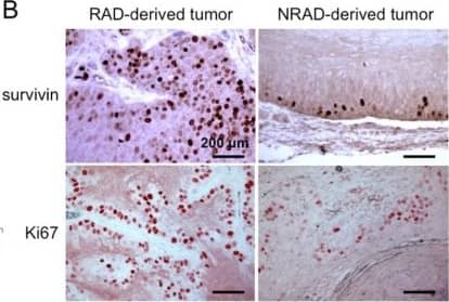 Immunohistochemistry: Survivin Antibody - BSA Free [NB500-201] - RAD & NRAD-derived tumor characterization. (A) Mitotic Index representing the number of cells undergoing mitosis over total cells were counted in RAD & NRAD-derived tumors **p < 0.01; (B) Survivin & Ki67 expression in RAD & NRAD-derived tumors by immunohistochemistry. Scale bar = 200 μm; (C) K10, E-FABP & involucrin expression in RAD & NRAD-derived tumors by immunohistochemistry. Scale bar = 200 μm. Image collected & cropped by CiteAb from the following publication (//www.mdpi.com/1422-0067/14/10/19540), licensed under a CC-BY license. Not internally tested by Novus Biologicals.