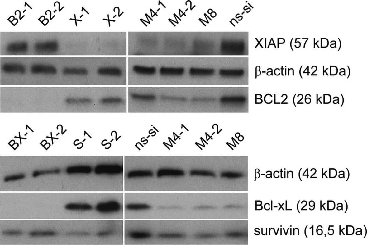 Western Blot: Survivin Antibody - BSA Free [NB500-201] - Detection of BCL2, Bcl-xL, XIAP & survivin protein content by western blotting 48 h after transfection with a total of 40 nM siRNA in EJ28 bladder cancer cells. Beta-actin was used for loading control. Image collected & cropped by CiteAb from the following publication (//www.spandidos-publications.com/10.3892/ijo.2012.1549), licensed under a CC-BY license. Not internally tested by Novus Biologicals.
