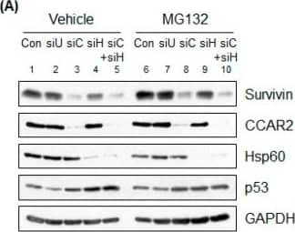 Western Blot: Survivin Antibody - BSA Free [NB500-201] - Deficiency of CCAR2 or Hsp60 reduces expression of survivin mRNA. SH-SY5Y (A–E) or BE(2)-M17 cells (E) were transfected with Universal (siU), CCAR2 (siC), or Hsp60 (siH) siRNA. (A,B) Forty-eight hours later, the level of survivin protein was examined by western blotting. Cells deficient in CCAR2 & Hsp60 were treated with 25 μM MG132 (A) or 100 μM chloroquine (B) 4 h or 24 h prior to cell lysis, respectively. (C,D) The level of survivin mRNA in each group of siRNA-transfected cells was measured by RT-PCR. (C) Levels were normalized against  beta -actin & quantified using ImageJ software. The relative level of survivin mRNA is expressed as the mean ± standard error of the mean (SEM) (n = 3). Asterisks (*) denote statistically significant differences (p < 0.05, one-way ANOVA). (D) Two different siRNAs targeting CCAR2 & Hsp60 were used to knock down their expressions. (E) The level of each protein was examined by western blotting. The relative level is expressed as the mean ± standard error of the mean (SEM) (n = 3). Indicators (*, #) denote statistically significant differences from the corresponding control cells (p < 0.05, one-way ANOVA). Image collected & cropped by CiteAb from the following publication (//pubmed.ncbi.nlm.nih.gov/30609639), licensed under a CC-BY license. Not internally tested by Novus Biologicals.