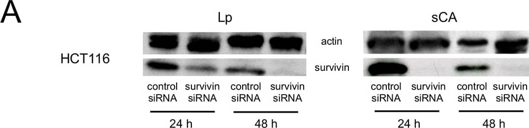 Western Blot: Survivin Antibody - BSA Free [NB500-201] - Anti-tumor effects & functional evidence of sCA-survivin-siRNA in HCT116 & HT29 solid tumor models.(A) For western blot analysis, HCT116 cells were seeded into 6-well plates & transfected with 100 pmol/well of either control or survivin siRNA by Lp (Lipofectamine 2000) or sCA. Actin blots served as loading controls. (B) For proliferation assays, cells were uniformly seeded into 96-well plates (1 × 104 cells/well), & 5 pmol/well siRNA was used. Cell viability was examined at 48 & 72 h by WST-8 assay. Data represent mean ± SEM. *P = 0.0294, **P = 0.0304 (n = 4, Wilcoxon rank test). (C) In vivo tumor growth. Each vehicle, carrying 15 μg of control siRNA or survivin siRNA, was administered by intravenous injection to mice with HCT116 tumors. Data represent the mean ± SEM (n = 10 tumors, Wilcoxon rank test). (D) Immunostaining of survivin in the tumor tissues on day 19. Scale bar, 50 μm. (E) In vivo live imaging of sCA-siRNA (6-FAM labeled) in HT29 tumor by multiphoton microscopy at 90 min. (F) Fluorescent detection of naked-siRNA (6-FAM labeled) or sCA-siRNA (6-FAM labeled) in the HT29 tumor at 4 h. Green: 6-FAM labeled siRNA; Red: microvasculature; Blue: DAPI stained nuclei. Scale bar, 50 μm. (G) Mice were administered with 40 μg of naked-survivin-siRNA or sCA-survivin-siRNA on days 0, 1, & 2. Tumors were removed on day 3, & western blot analysis for survivin was performed. (H) Many tumor cells treated with sCA-survivin-siRNA (6-FAM labeled) had condensed nuclei & were positive for TUNEL assay. Scale bar, 50 μm. Image collected & cropped by CiteAb from the following publication (//pubmed.ncbi.nlm.nih.gov/25738937), licensed under a CC-BY license. Not internally tested by Novus Biologicals.