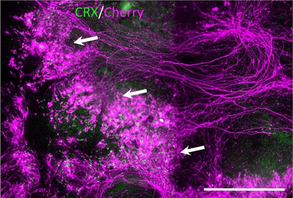 Immunocytochemistry/ Immunofluorescence CRX/CORD2 Antibody (4G11) - Azide and BSA Free