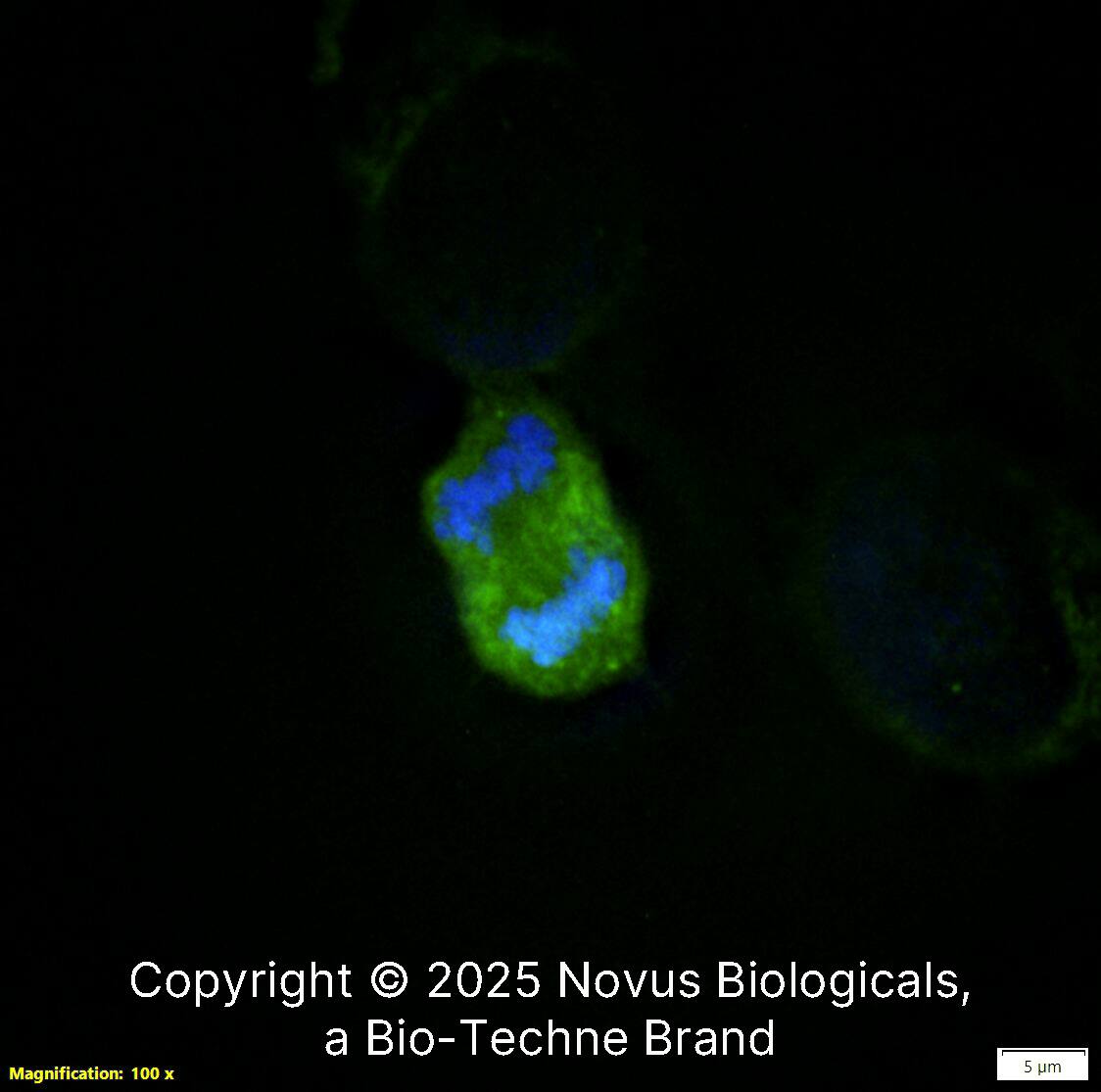 Survivin (32.1) was detected in immersion fixed U-2 OS human osteosarcoma cell line using Mouse anti-Survivin (32.1) Protein G Purified Monoclonal Antibody conjugated to FITC (Catalog # NB500-237F) (green) at 10 µg/mL overnight at 4C. Cells were counterstained with DAPI (blue). Cells were imaged using a 100X objective and digitally deconvolved.  