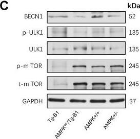 Western Blot: Beclin 1 Antibody - BSA Free [NB500-249] - AMPK knockout interrupts & decreases apoptosis in cochlea. (C) WB results show changes in autophagy-related proteins in cochleae of aging mice. There is a remarkable decline of mTOR signaling (Tg-B1 vs. AMPK+/−/Tg-B1, p<0.0001; Tg-B1 vs. WT, p=0.0001) & more Beclin-1 (Tg-B1 vs. AMPK+/−/Tg-B1, p<0.0001, one-way ANOVA followed by Bonferroni post-test) expressed in cochleae of Tg-B1 mice. (D) The histograms of WB analyses show knockouts of AMPK relieve the ROS-induced autophagic stress in Tg-B1 mice. Analysis performed by using Image J software & one-way ANOVA followed by Bonferroni post-test. * P<0.05, ** P<0.01, ***P<0.001, **** P<0.0001; n=3 per group. Image collected & cropped by CiteAb from the following publication (//pubmed.ncbi.nlm.nih.gov/32240104), licensed under a CC-BY license. Not internally tested by Novus Biologicals.