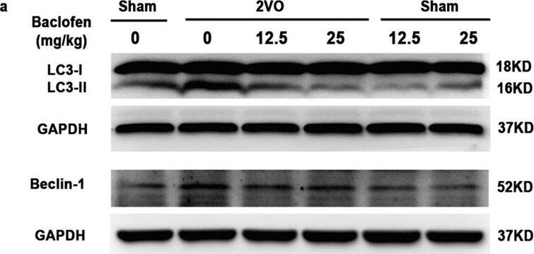 Western Blot: Beclin 1 Antibody - BSA Free [NB500-249] - Baclofen reversed the changes of protein markers characteristic for autophagy in hippocampal CA1 area under chronic cerebral hypoperfusion.(a–c) Five weeks after induction of hypoperfusion, p-mTOR was significantly decreased, & LC3-II, Beclin 1, atg5 & atg7 were significantly increased, & baclofen could reverse the changes of these proteins expression. Treatment with baclofen at 12.5 mg/kg & 25 mg/kg in sham-operated rats did not change the expression of LC3-II, mTOR, p-mTOR, Beclin 1, atg5 & atg7 compared with sham-operated rats (n = 4 in each group). Blots shown have been cropped to fit space requirements & run under the same experimental conditions. *P < 0.05 & **P < 0.01 vs sham-operated rats; ##P < 0.01 vs 2VO rats. Image collected & cropped by CiteAb from the following publication (//www.nature.com/articles/srep14474), licensed under a CC-BY license. Not internally tested by Novus Biologicals.