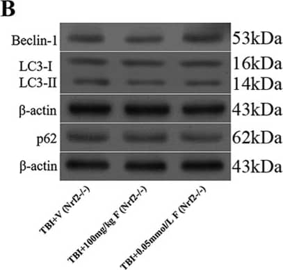 Western Blot: Beclin 1 Antibody - BSA Free [NB500-249] - Representative Western blot images and quantitative analyses of Beclin 1 from the left hemisphere of rat brains at different time points after SAH. Sample size is 36, n = 6 per group. Data were presented as mean +/- SD. F = 12.37 for Beclin 1. *P  0.05 versus TBI + vehicle group.  beta -actin was used as a loading control. Image collected & cropped by CiteAb from the following publication (//pubmed.ncbi.nlm.nih.gov/28429775), licensed under a CC-BY license. Not internally tested by Novus Biologicals.