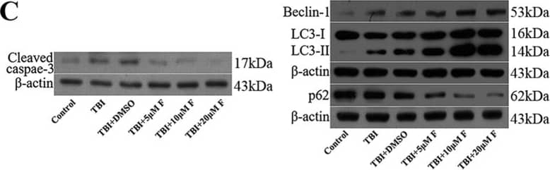 Western Blot: Beclin 1 Antibody - BSA Free [NB500-249] - AMPK knockout interrupts & decreases apoptosis in cochlea. (C) WB results show changes in autophagy-related proteins in cochleae of aging mice. There is a remarkable decline of mTOR signaling (Tg-B1 vs. AMPK+/−/Tg-B1, p 0.05 versus TBI + DMSO group.  beta -actin was used as a loading control. Image collected & cropped by CiteAb from the following publication (//pubmed.ncbi.nlm.nih.gov/28429775), licensed under a CC-BY license. Not internally tested by Novus Biologicals.