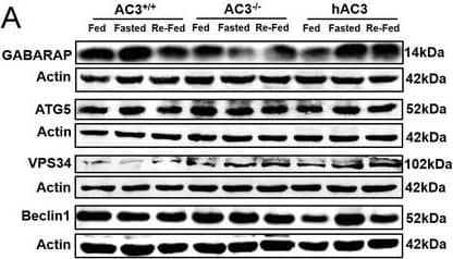 Western Blot: Beclin 1 Antibody - BSA Free [NB500-249] - GABARAP interacts with AC3 via LIRs of AC3 in a ciliary expression‐dependent manner. A‐E) WB (A) & densitometric quantification of the expression of GABARAP (B), ATG5 (C), VPS34 (D), & Beclin1(E) in the hypothalami of AC3+/+, AC3−/−, & hAC3 mice (n = 3 mice per group). Actin served as the loading control. F) Representative IF co‐staining with AC3 & GABARAP antibodies in the VMHs of WT mice. F′) A higher magnification of the boxed region. Scale bars: F) 20 µm; F′) 5 µm. G) Representative images showing the expression levels of GABARAP & AC3 in the VMHs of VMH pIFT88‐AC3 KD mice & the controls. Scale bars: 20 µm. H) Schematic representation of GABARAP binding LIRs at aa488‐aa493 & aa958‐aa963 of AC3. I) Co‐IP analysis of GABARAP & AC3 (WT), AC3 (LIR1 Mut), or AC3 (LIR2 Mut). LgG served as the negative control. J) Pull‐down analysis of GABARAP & AC3. K) Co‐IP analysis of GABARAP & AC3 (WT), AC3 (296 Mut), or AC3 (465 Mut). LgG served as the negative control. L) Schematic representation of AC3 regulating GABARAP. Data represent the mean ± SEM; *p < 0.05 & **p < 0.01; one‐way ANOVA & Bonferroni pairwise comparisons. Image collected & cropped by CiteAb from the following publication (//pubmed.ncbi.nlm.nih.gov/34783461), licensed under a CC-BY license. Not internally tested by Novus Biologicals.