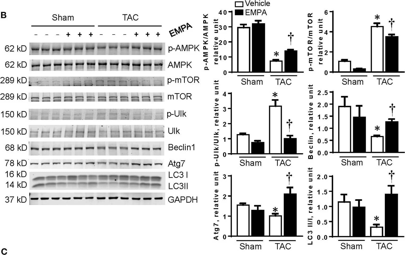 Western Blot: Beclin 1 Antibody - BSA Free [NB500-249] - EMPA treatment enhanced autophagy in failing hearts. (A) Transmission electron microscopy (TEM) showed autophagosomes in the hearts. Red arrows point to autophagosomes. (B) EMPA activated autophagy pathway by inhibiting mTOR pathway. (C) RT-PCR results showed that the mRNA expression of Beclin1, Atg7 & LC3 were increased by EMPA treatment after TAC. Results are expressed as mean ± SEM, n = 5–7, *p < 0.05 vs. corresponding sham group, †p < 0.05 vs. corresponding TAC vehicle group. One-way ANOVA & Tukey post hoc test. EMPA, empagliflozin; SEM, standard error of the mean; TAC, transverse aortic constriction; AMPK, AMP-activated protein kinase; mTOR, mammalian target of rapamycin; Ulk, Unc-51 like autophagy activating kinase; Atg7, autophagy related 7; LC3, light chain 3; GAPDH, glyceraldehyde 3-phosphate dehydrogenase. Image collected & cropped by CiteAb from the following publication (//pubmed.ncbi.nlm.nih.gov/35647080), licensed under a CC-BY license. Not internally tested by Novus Biologicals.