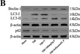 Western Blot: Beclin 1 Antibody - BSA Free [NB500-249] - Fucoxanthin activated autophagy after TBI.(A) Representative images of immunofluorescence for LC3 surrounding the injured cortex. LC3 punctate dots were observed in the cytoplasm by immunofluorescent staining of LC3 (red). Neuron cells & nuclei are labeled with NeuN (green) & DAPI (blue), respectively. Magnification: 40 x. Scale bar: 50 mm. (B) Mice brain tissues were collected 1 day after TBI in different groups, & the expression of LC3, Beclin-1 & p62 was measured by western blot. Fucoxanthin treatment significantly increased the level of LC3-II & Beclin-1 while decreasing the level of p62 after TBI. (C) 3-MA (400 nM) was injected i.c.v. 30 min before TBI. Mice were then subjected to TBI & treatment of fucoxanthin 30 min after TBI. Pretreatment with 3-MA significantly attenuated fucoxanthin-induced activation of autophagy & suppression of apoptosis & oxidative stress in the ipsilateral cortex. Data are presented as mean ± SEM, n = 6 per group; **p < 0.01, ***p < 0.001 versus sham group; #p < 0.05, ##p < 0.01 versus TBI + vehicle group; &&p < 0.01, &&&p < 0.001 versus TBI + fucoxanthin group.  beta -actin was used as a loading control. Image collected & cropped by CiteAb from the following publication (//pubmed.ncbi.nlm.nih.gov/28429775), licensed under a CC-BY license. Not internally tested by Novus Biologicals.