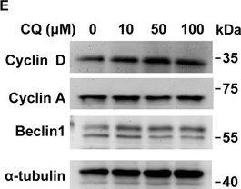 Western Blot: Beclin 1 Antibody - BSA Free [NB500-249] - Inhibition of lysosomes leads to G1 arrest by inactivating cyclin E/CDK2 complex. (A) CQ treatment (10, 50, or 100 μM, 24 h) leads to cell cycle G1 arrest. Quantitation of different cell cycle stages in TM3 cells in the presence or absence of CQ. (B–D) EdU incorporation & mitotic index are reduced in CQ-treated TM3 cells. (B) Immunostaining of EdU (red) & DAPI (blue) in scramble control (CTL) or CQ treated TM3 cells. Quantitation of EdU incorporation (C) or mitotic index (D) in scramble control (CTL) or CQ-treated TM3 cells. These results are mean +/− SD from three independent experiments; more than 1000 cells were counted in each individual group. (E–G) CQ inhibited cyclin E1 expression & CDK2 activation. (E,F) Whole cell extracts of CQ-treated TM3 cells at the concentration of 10, 50, or 100 μM are analyzed by immunoblot with antibodies against Beclin1, cyclin D, cyclin A, cyclin E1, CDK2, phosphorylated CDK2 at Thr160 (pCDK2) &  alpha -tubulin. (G) Quantitation of relative intensity of cyclin E & pCDK2 in (F). *P < 0.05; **P < 0.01; ***P < 0.001. Image collected & cropped by CiteAb from the following publication (//www.nature.com/articles/s41598-017-00393-4), licensed under a CC-BY license. Not internally tested by Novus Biologicals.