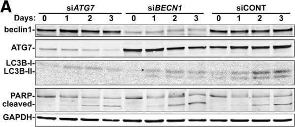 Western Blot: Beclin 1 Antibody - BSA Free [NB500-249] - Inhibition of lysosomes leads to G1 arrest by inactivating cyclin E/CDK2 complex. (A) CQ treatment (10, 50, or 100 μM, 24 h) leads to cell cycle G1 arrest. Quantitation of different cell cycle stages in TM3 cells in the presence or absence of CQ. (B–D) EdU incorporation & mitotic index are reduced in CQ-treated TM3 cells. (B) Immunostaining of EdU (red) & DAPI (blue) in scramble control (CTL) or CQ treated TM3 cells. Quantitation of EdU incorporation (C) or mitotic index (D) in scramble control (CTL) or CQ-treated TM3 cells. These results are mean +/− SD from three independent experiments; more than 1000 cells were counted in each individual group. (E–G) CQ inhibited cyclin E1 expression & CDK2 activation. (E,F) Whole cell extracts of CQ-treated TM3 cells at the concentration of 10, 50, or 100 μM are analyzed by immunoblot with antibodies against Beclin1, cyclin D, cyclin A, cyclin E1, CDK2, phosphorylated CDK2 at Thr160 (pCDK2) &  alpha -tubulin. (G) Quantitation of relative intensity of cyclin E & pCDK2 in (F). *P 50 cells were counted under a dissecting microscope. Image collected & cropped by CiteAb from the following publication (//jhoonline.biomedcentral.com/articles/10.1186/1756-8722-7-23), licensed under a CC-BY license. Not internally tested by Novus Biologicals.