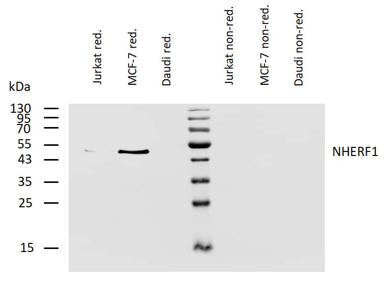 Analysis of human NHERF1 using mouse monoclonal antibody EBP-10 on lysates of Jurkat, MCF-7, and Daudi cells under reducing and non-reducing conditions. Nitrocellulose membrane was probed with 2 µg/ml of mouse anti-NHERF1 monoclonal antibody followed by IRDye800-conjugated anti-mouse secondary antibody. NHERF1 was detected around 50 kDa.