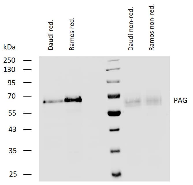 Analysis of human PAG using rabbit polyclonal antibody PAb (409) on lysates of Daudi and Ramos cell line under reducing and non-reducing conditions. Nitrocellulose membrane was probed with 2 µg/ml of rabbit anti-PAG monoclonal antibody followed by IRDye800-conjugated anti-rabbit secondary antibody. PAG was detected around 65 kDa.