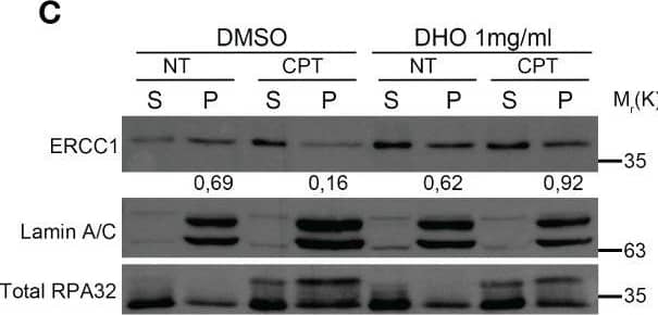 DHO hydrophilic extract increases the Single Strand Annealing activity in response to CPT treatment (A) Chromatin enhriched purification of HeLa cells pretreated or not with the DHO extract at 1 mg/ml followed by 1 μM CPT treatment for additional two hours. Cells were then lysed to obtain a soluble (S) and a chromatin-enriched (P, as pellet) fraction. Western blotting was performed to analyse the loading onto chromatin of the Poly (ADP-ribose) polymerase (PARP1) protein, involved in the cell response to DNA damage. Total RPA32 and Lamin A/C were used as controls of the supernatant or the chromatin-enriched fraction, respectively. (B) Chromatin enhriched purification of HeLa cells performed as previously for the analysis of RAD52 chromatin loading. (C) Chromatin enhiched purification of HeLa cells was performed as previously described followed by incubation with ERCC1 antibody. (D) HeLa hprtSAGFP cells were transfected with the plasmid encoding the SceI restriction enzyme followed by incubation with 1 mg/ml of DHO extract or vehicle (DMSO) for 48 hours followed by FACS analysis measurement of GFP levels to calculate %SSA frequency compared with control cells which were set as 100%. Data represent the mean % +/- SD. obtained from three independent experiments. Statistically significant differences are indicated with: ***significant (P < 0.001). Image collected and cropped by CiteAb from the following open publication (//pubmed.ncbi.nlm.nih.gov/37409248), licensed under a CC-BY license. Not internally tested by Novus Biologicals.