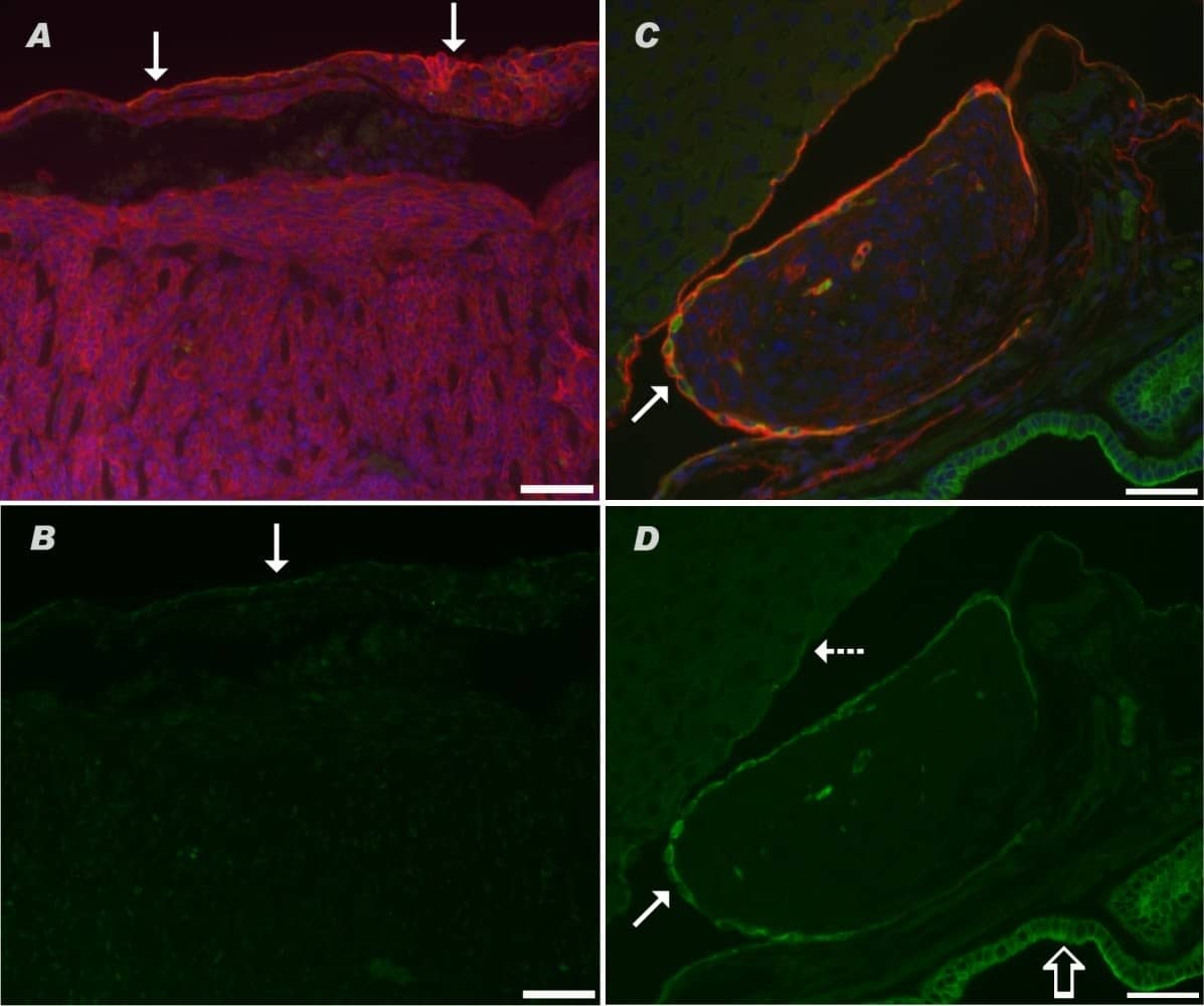 Immunocytochemistry/ Immunofluorescence: Podoplanin Antibody (8.1.1) - BSA Free [NB600-1015] - Immunofluorescence staining for podoplanin (red) & cytokeratins (green) in malignant serosal tumors morphologically consistent with sarcomatous mesothelioma. In A, the lining mesothelium (solid arrows) stained positively for podoplanin in this double label immunofluorescent image of diaphragm. The cells beneath the mesothelial lining are also red due to expression of podoplanin & these are cells of a malignant serosal tumor. In B, only the single label green fluorescence is shown to demonstrate weak expression of cytokeratins in the lining mesothelium (solid arrow), while staining of the subjacent tumor for cytokeratins is equivocal. In C, a double label immunofluorescent image demonstrates a malignant serosal tumor between the liver & gall bladder that is lined by reactive mesothelium (solid arrow) which stains red for podoplanin as well as green for cytokeratins. The cells of the subjacent malignant serosal tumor stain weakly red for podoplanin. In D, the photomicrograph shows this same tumor but only the green fluorescence for cytokeratins. The reactive mesothelium lining the malignant serosal tumor (solid arrow) stains green for cytokeratins while the serosal tumor has no evidence of cytokeratin expression. The normal mesothelium lining the liver is weakly positive for cytokeratins (dashed arrow). The epithelium lining the gall bladder (open arrow) strongly expresses cytokeratins. Magnification bar is 50 μm. Image collected & cropped by CiteAb from the following publication (//particleandfibretoxicology.biomedcentral.com/articles/10.1186/1743-8977-11-3), licensed under a CC-BY license. Not internally tested by Novus Biologicals.