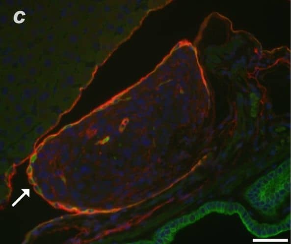 Immunocytochemistry/ Immunofluorescence: Podoplanin Antibody (8.1.1) - BSA Free [NB600-1015] - Immunofluorescence staining for podoplanin (red) & cytokeratins (green) in malignant serosal tumors morphologically consistent with sarcomatous mesothelioma. In A, the lining mesothelium (solid arrows) stained positively for podoplanin in this double label immunofluorescent image of diaphragm. The cells beneath the mesothelial lining are also red due to expression of podoplanin & these are cells of a malignant serosal tumor. In B, only the single label green fluorescence is shown to demonstrate weak expression of cytokeratins in the lining mesothelium (solid arrow), while staining of the subjacent tumor for cytokeratins is equivocal. In C, a double label immunofluorescent image demonstrates a malignant serosal tumor between the liver & gall bladder that is lined by reactive mesothelium (solid arrow) which stains red for podoplanin as well as green for cytokeratins. The cells of the subjacent malignant serosal tumor stain weakly red for podoplanin. In D, the photomicrograph shows this same tumor but only the green fluorescence for cytokeratins. The reactive mesothelium lining the malignant serosal tumor (solid arrow) stains green for cytokeratins while the serosal tumor has no evidence of cytokeratin expression. The normal mesothelium lining the liver is weakly positive for cytokeratins (dashed arrow). The epithelium lining the gall bladder (open arrow) strongly expresses cytokeratins. Magnification bar is 50 μm. Image collected & cropped by CiteAb from the following publication (//particleandfibretoxicology.biomedcentral.com/articles/10.1186/1743-8977-11-3), licensed under a CC-BY license. Not internally tested by Novus Biologicals.