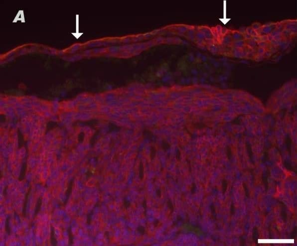 Immunocytochemistry/ Immunofluorescence: Podoplanin Antibody (8.1.1) - BSA Free [NB600-1015] - Immunofluorescence staining for podoplanin (red) & cytokeratins (green) in malignant serosal tumors morphologically consistent with sarcomatous mesothelioma. In A, the lining mesothelium (solid arrows) stained positively for podoplanin in this double label immunofluorescent image of diaphragm. The cells beneath the mesothelial lining are also red due to expression of podoplanin & these are cells of a malignant serosal tumor. In B, only the single label green fluorescence is shown to demonstrate weak expression of cytokeratins in the lining mesothelium (solid arrow), while staining of the subjacent tumor for cytokeratins is equivocal. In C, a double label immunofluorescent image demonstrates a malignant serosal tumor between the liver & gall bladder that is lined by reactive mesothelium (solid arrow) which stains red for podoplanin as well as green for cytokeratins. The cells of the subjacent malignant serosal tumor stain weakly red for podoplanin. In D, the photomicrograph shows this same tumor but only the green fluorescence for cytokeratins. The reactive mesothelium lining the malignant serosal tumor (solid arrow) stains green for cytokeratins while the serosal tumor has no evidence of cytokeratin expression. The normal mesothelium lining the liver is weakly positive for cytokeratins (dashed arrow). The epithelium lining the gall bladder (open arrow) strongly expresses cytokeratins. Magnification bar is 50 μm. Image collected & cropped by CiteAb from the following publication (//particleandfibretoxicology.biomedcentral.com/articles/10.1186/1743-8977-11-3), licensed under a CC-BY license. Not internally tested by Novus Biologicals.