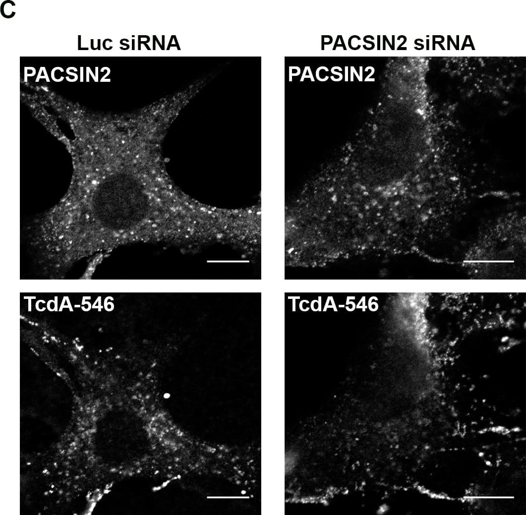 Immunocytochemistry/ Immunofluorescence: Clostridium Difficile Toxin A Antibody (PCG4.1) - BSA Free [NB600-1066] - PACSIN2 is required for TcdA uptake & toxin-induced rounding in wildtype MEF cells. (C), (D) & (E). Depletion of PACSIN2 reduces TcdA uptake in MEF cells. Wildtype MEF cells expressing luciferase (luc) or PACSIN2 siRNA incubated with 50 nM TcdA-546 at 10°C for 45 min. Cells allowed to warm up to 37°C for 2 min & then washed to remove unbound toxins & incubated with fresh media prewarmed to 37°C. Bound toxins allowed to internalize for 9 min at 37°C. Cells then fixed, stained for PACSIN2 & imaged by confocal microscopy. PACSIN2 & TcdA-546 staining from each condition shown in (C). Scale bars, 10 μm. The images shown representative of multiple fields imaged from two independent experiments. (D) Comparison of mean fluorescence intensities of PACSIN2 between luc & PACSIN2 siRNA transfected cells. Data represent mean & SD of 101 individual cells. Student’s t test ***p<0.0001. (E) Comparison of mean fluorescence intensities of TcdA-546 between luc & PACSIN2 siRNA transfected cells. Data represent mean & SD of 101 individual cells. Student’s t test ***p<0.0001. Cells chosen at random for intensity analyses. Image collected & cropped by CiteAb from the following publication (//dx.plos.org/10.1371/journal.ppat.1006070), licensed under a CC0-1.0 license. Not internally tested by Novus Biologicals.