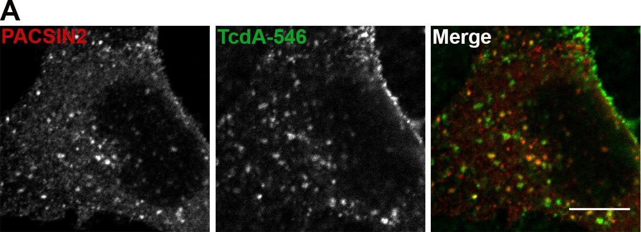 Immunocytochemistry/ Immunofluorescence: Clostridium Difficile Toxin A Antibody (PCG4.1) - BSA Free [NB600-1066] - TcdA colocalizes with PACSIN2 in wildtype MEF cells.(A) Wildtype MEFs on glass coverslips were allowed to bind 50 nM TcdA-546 for 45 min at 10°C, & cells were shifted to 37°C to allow internalization of toxin for 3 min. Cells were fixed, stained for PACSIN2, & analyzed by confocal microscopy. Merged images show PACSIN2 in red, toxin in green, & colocalization in yellow. Scale bars, 10 μm. The images shown are representative of multiple fields imaged from two independent experiments. (B) Immunofluorescence assays were performed as described in (A), but cells were stained for cav1 in addition to PACSIN2. Merged images show PACSIN2 in red, toxin in green, & cav1 in blue. Yellow puncta in merged images denote TcdA- & PACSIN2-positive structures. Pink punta denote caveolae-associated PACSIN2. Scale bars, 10 μm. (C) Pearson’s correlation coefficient to assess the extent of colocalization between PACSIN2, cav1 & TcdA-546 after 3 min toxin uptake. Data represent mean & SD of 31 individual cells chosen at random. Image collected & cropped by CiteAb from the following publication (//dx.plos.org/10.1371/journal.ppat.1006070), licensed under a CC0-1.0 license. Not internally tested by Novus Biologicals.