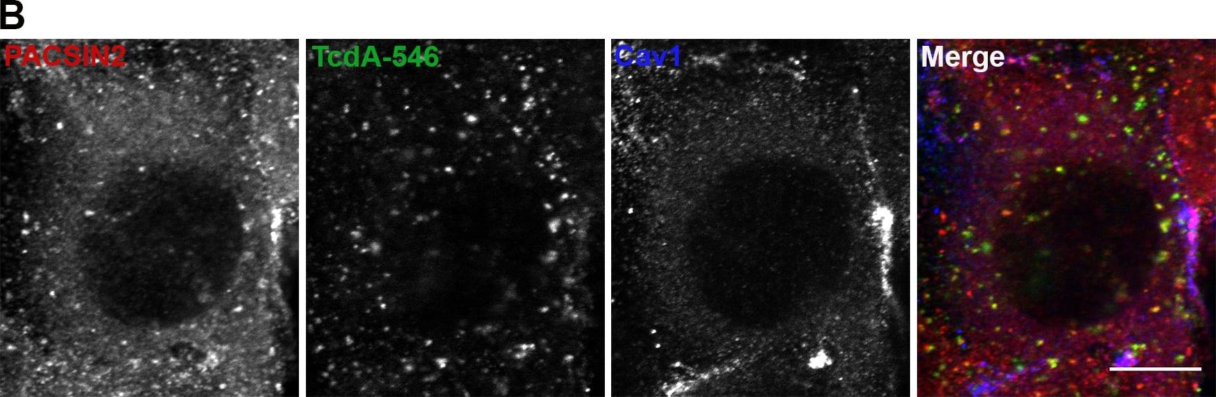 Immunocytochemistry/ Immunofluorescence: Clostridium Difficile Toxin A Antibody (PCG4.1) - BSA Free [NB600-1066] - TcdA colocalizes with PACSIN2 in wildtype MEF cells.(A) Wildtype MEFs on glass coverslips were allowed to bind 50 nM TcdA-546 for 45 min at 10°C, & cells were shifted to 37°C to allow internalization of toxin for 3 min. Cells were fixed, stained for PACSIN2, & analyzed by confocal microscopy. Merged images show PACSIN2 in red, toxin in green, & colocalization in yellow. Scale bars, 10 μm. The images shown are representative of multiple fields imaged from two independent experiments. (B) Immunofluorescence assays were performed as described in (A), but cells were stained for cav1 in addition to PACSIN2. Merged images show PACSIN2 in red, toxin in green, & cav1 in blue. Yellow puncta in merged images denote TcdA- & PACSIN2-positive structures. Pink punta denote caveolae-associated PACSIN2. Scale bars, 10 μm. (C) Pearson’s correlation coefficient to assess the extent of colocalization between PACSIN2, cav1 & TcdA-546 after 3 min toxin uptake. Data represent mean & SD of 31 individual cells chosen at random. Image collected & cropped by CiteAb from the following publication (//dx.plos.org/10.1371/journal.ppat.1006070), licensed under a CC0-1.0 license. Not internally tested by Novus Biologicals.