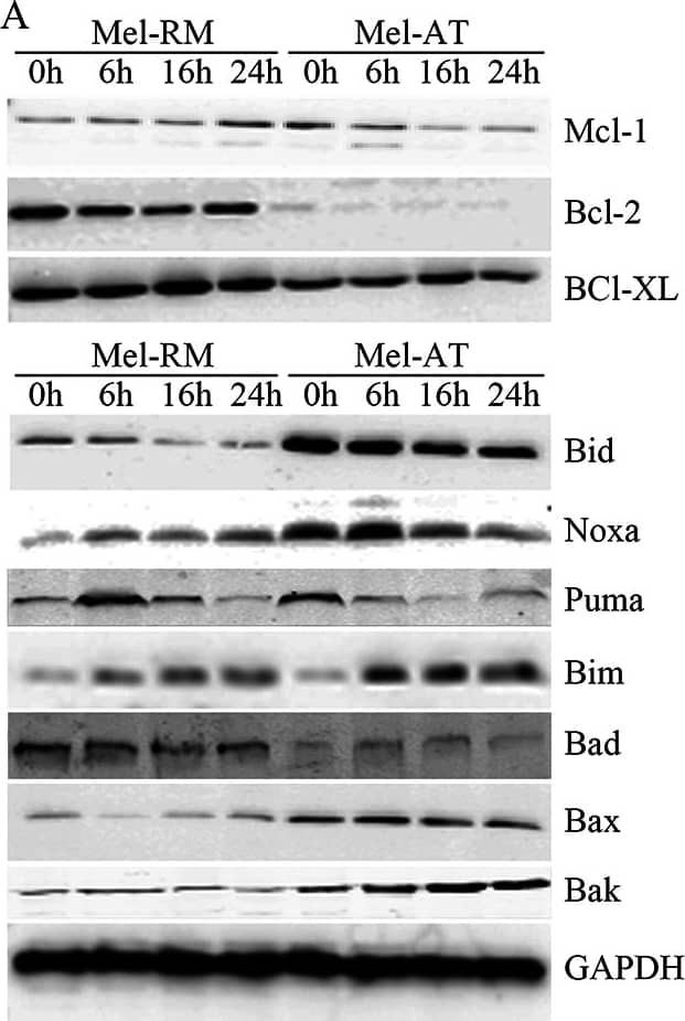 Western Blot: Noxa Antibody (114C307.1) - Non-Recombinant Monoclonal [NB600-1159] - EGb761 regulates Bcl-2 family proteins expression in melanoma cells.(A) EGb761 alters the expression levels of anti- & pro-apoptotic Bcl-2 family proteins in melanoma cell lines. Whole cell lysates from Mel-RM & Mel-AT cells treated with EGb761 (400 μg/ml) for indicated time periods were subjected to Western blot analysis. The data shown are representative of three individual experiments. (B) 5% ethanol as control vehicle did not alter the expression levels of Mcl-1. Mel-AT cells with 5% ethanol for increasing periods. Whole cell lysates from Mel-AT cells treated were subjected to Western blot analysis. The data shown are representative of three individual experiments.(C) Mel-RM & Mel-AT cells were treated with EGb761 (400 μg/ml) or 5% ethanol for the indicated periods. Total RNA was isolated & subjected to real-time PCR analysis for Mcl-1. The relative abundance of mRNA expression treated with 5% ethanol was arbitrarily designated as 1. Columns, mean of three individual experiments; bars, SEM. * Present p<0.05 vs control.(D) Relative expression of anti-apoptosis Bcl-2 family proteins in melanoma cell lines Mel-RM & Mel-AT without treatment. Quantitative expression levels of Mcl-1, Bcl-2 & Bcl-XL were normalized to GAPDH.(E) Relative expression of pro-apoptosis Bcl-2 family proteins in melanoma cell lines Mel-RM & Mel-AT without treatment. Quantitative expression levels of Bax, Bid, Noxa, PUMA, Bim, Bad & Bak were normalized to GAPDH. Image collected & cropped by CiteAb from the following publication (//pubmed.ncbi.nlm.nih.gov/25860257), licensed under a CC-BY license. Not internally tested by Novus Biologicals.