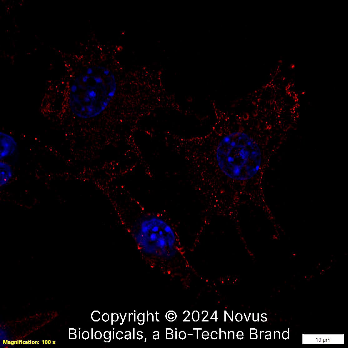 CD11b (M1/70.15) was detected in immersion fixed Raw 264.7 mouse macrophage cell line using Rat anti-CD11b (M1/70.15) Protein-G purified Monoclonal Antibody conjugated to DyLight 550 (Catalog # NB600-1327R) (red) at 10 µg/mL overnight at 4C. Cells were counterstained with DAPI (blue). Cells were imaged using a 100X objective and digitally deconvolved.  