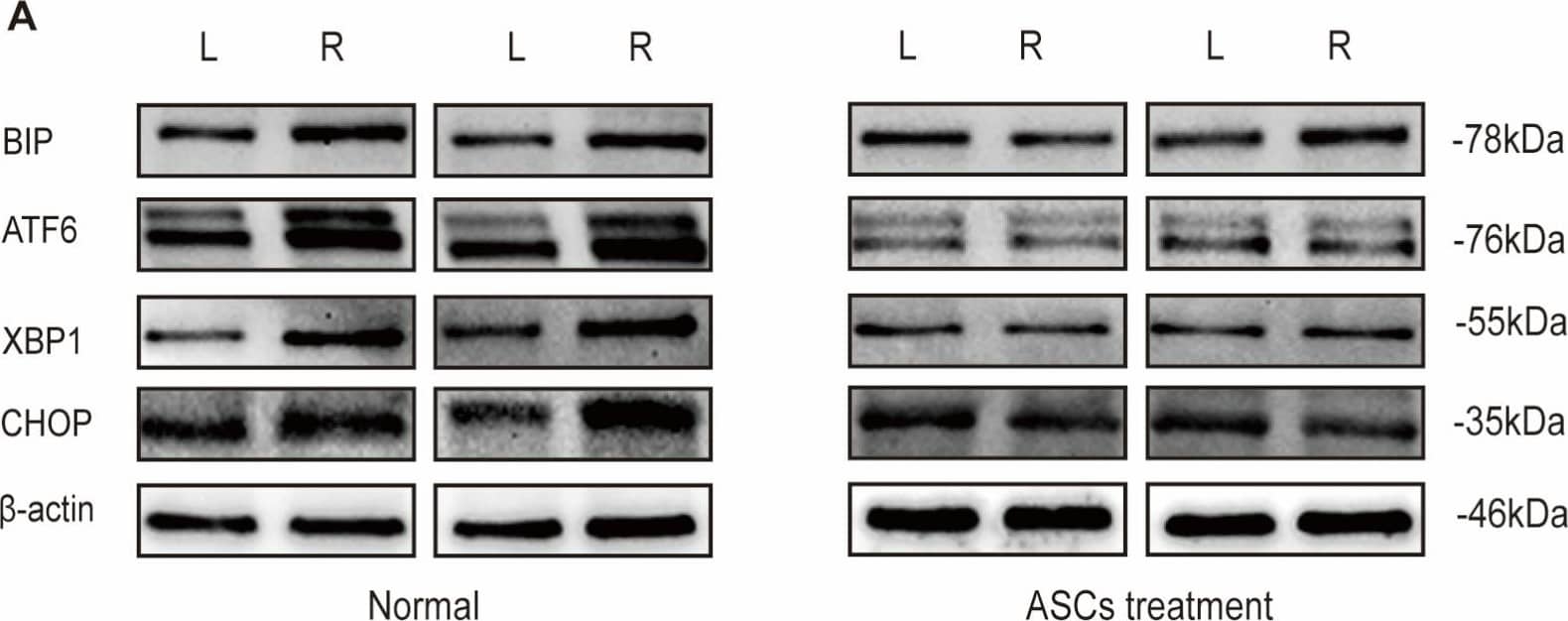 ASCs lead to changes in UPR expression in vivo (A) The comparison of the left and right legs—with DLFA- of the two groups of mice are shown (B) Ratio between BIP expression between left and right leg with and without ASCs (C) Ratio of ATF6 expression between left and right leg with and without ASCs (D) Ratio of CHOP expression between left and right leg with and without ASCs (E) Ratio of XBP1 expression between left and right leg with and without ASCs (n = 3, ANOVA, * p ≤ 0.05, ** p ≤ 0.01). Image collected and cropped by CiteAb from the following open publication (//www.mdpi.com/1422-0067/24/24/17197), licensed under a CC-BY license. Not internally tested by Novus Biologicals.