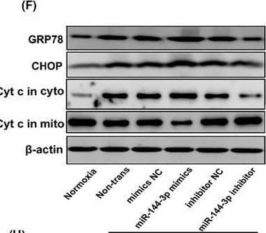 MiR‐144‐3p regulates H/R‐induced Nrf2‐HO‐1 signaling pathway activation, oxidative stress, mitochondria and endoplasmic reticulum functions in vitro. A–C, The expression levels of Nrf2 and HO‐1 in TCMK cells transfected with miR‐144‐3p mimics or inhibitor after H/R treatment. Representative bands are shown in A, and the quantitative analysis of protein expression level is shown in B, C (n = 3). D, E, The SOD and MDA levels in cellular supernatant of TCMK cells transfected with miR‐144‐3p mimics or inhibitor after H/R treatment (n = 3). F–I, The expression levels of CHOP, GRP78 and Cytochrome C in TCMK cells transfected with miR‐144‐3p mimics or inhibitor after H/R treatment. Representative bands are shown in F, and the quantitative analysis of protein expression level is shown in G–I (n = 3). All data are expressed as the mean +/- SD; data comparisons between multiple groups were performed using one‐way analysis of variance (ANOVA) with Tukey's post hoc test. *p < 0.05, **p < 0.01 Image collected and cropped by CiteAb from the following open publication (//pubmed.ncbi.nlm.nih.gov/34547172), licensed under a CC-BY license. Not internally tested by Novus Biologicals.