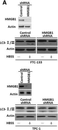 HMGB1 regulated autophagy in thyroid cancer cells (a) FTC-133/TPC-1 cells were transfected with HMGB1 shRNA & control shRNA & then starved by HBSS for 2 h. & LC3-I/II level was assayed by Western blot; (b) FTC-133/TPC-1 cells were transfected with HMGB1 shRNA & control shRNA & then pre-treated for 1 h with pepstatin A (PA, 10 μM) & E64D (10 μM) as indicated. Cells were subsequently treated for 3 h with HBSS in continuous presence or absence PA/E64D inhibitors. LC3-I/II, Beclin1 & p62 levels were assayed by Western blot; (c) Ultrastructural features in FTC-133/TPC-1 cells transfected with HMGB1 shRNA & control shRNA after a 3-h treatment of HBSS. More autophagosomes were seen in control shRNA plus HBSS-treated cells than in cells treated with HMGB1 shRNA plus HBSS. Arrows indicated autophagosomes Image collected & cropped by CiteAb from the following publication (//pubmed.ncbi.nlm.nih.gov/31331356), licensed under a CC-BY license. Not internally tested by Novus Biologicals.