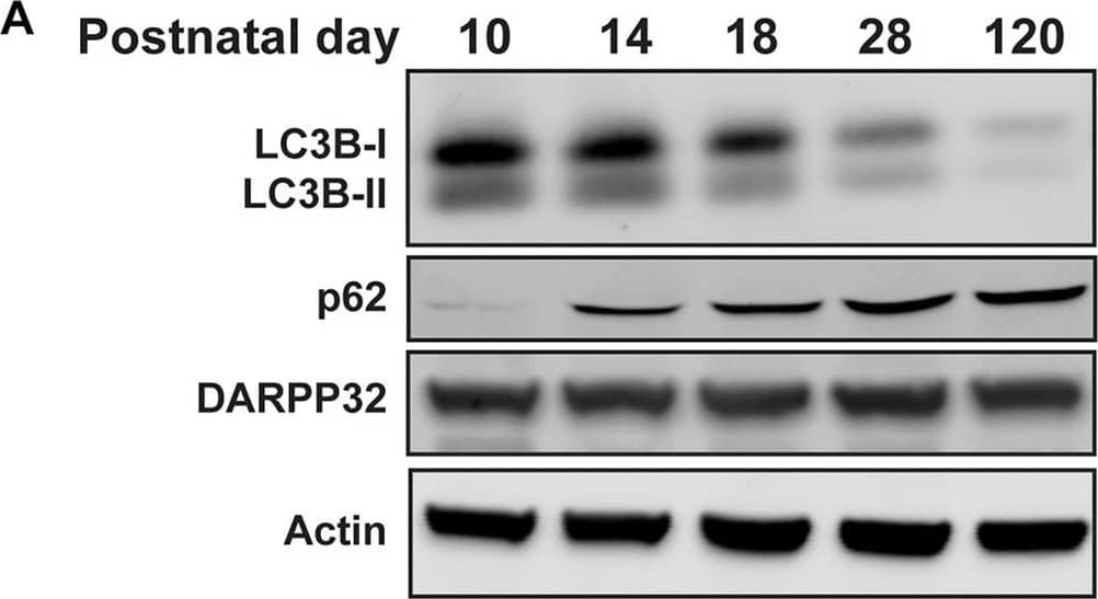 Western Blot: LC3B Antibody - BSA Free [NB600-1384] - Autophagy decreases during striatal development. (A) Representative Western blot images for LC3B, p62, DARPP32, & actin. Quantification of (B) LC3B-ii relative to actin, (C) LC3B-ii relative to LC3B-i, (D) p62 relative to actin normalized to P120 values. Data analyzed with one-way ANOVA; (B) Age: F(4,21) = 6.526, p = 0.0014; (C) Age: F(4,22) = 3.797, p = 0.0171; (D) Age: F(4,15) = 3.762, p = 0.0260. *p < 0.05, **p < 0.01, n = 4–6 mice/age. (E,F) Representative images of DARPP32 stained striatal neurons & RFP fluorescence from mice aged P10 & P28. Dashed lines indicate cell body outlines. (G) Quantification of number of LC3 puncta/cell. Unpaired, two-tailed t-test, t4 = 4.392, p = 0.0118. N = 3 mice/age, 20–50 cells were analyzed per mouse. Image collected & cropped by CiteAb from the following publication (//pubmed.ncbi.nlm.nih.gov/32296308), licensed under a CC-BY license. Not internally tested by Novus Biologicals.