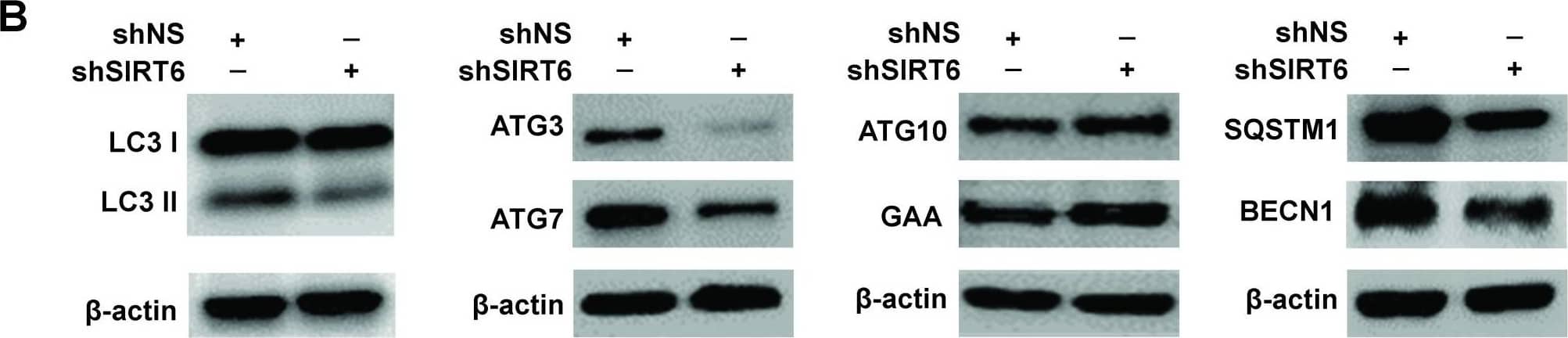 Western Blot: LC3B Antibody - BSA Free [NB600-1384] - Validation of modulations in autophagy-related markers after SIRT6 knockdown in melanoma cells(A) RT-qPCR analysis was performed to validate the mRNA levels in key altered genes after SIRT6 knockdown A375 cells. Results are expressed as SIRT6 knockdown (shSIRT6) mRNA levels compared to nonsense control (shNS). Data are mean ±SE of three biological replicates, with statistical significance denoted as *P≤ 0.05. (B) Western blot analyses of various autophagy markers including LC3 I & II, BECN1, SQSTM1, ATG3, ATG7, ATG10 & GAA using cell lysates of shNS & shSIRT6 in A375 melanoma cells.  beta -actin was used as loading control. The figure shows representative western blot images from 2-3 experiments. Image collected & cropped by CiteAb from the following publication (//www.genesandcancer.com/lookup/doi/10.18632/genesandcancer.153), licensed under a CC-BY license. Not internally tested by Novus Biologicals.