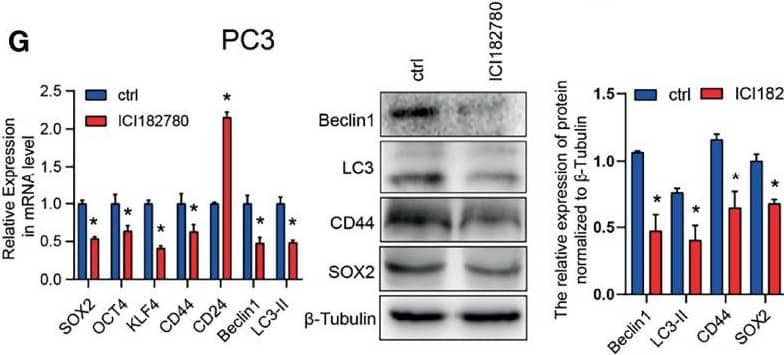 Western Blot: LC3B Antibody - BSA Free [NB600-1384] - The activated HeyL-aromatase axis promotes autophagic survival of PCSCs. (A) Gene signatures associated with autophagy-associated signaling pathways identified by GSEA in HeyLHigh samples vs. HeyLLow samples from the TCGA-PRAD dataset & in HeyL knockdown cells vs. ctrl cells. (B, C) Western blot analysis of Beclin1, LC3, & CD44 in LNCaP (B) & PC3 (C) cells after the indicated treatments. (D) Flow cytometry analysis of the CD44+/CD24− subpopulation in PC3 cells treated as indicated. (E, F) mRNA (E) & protein (F) levels of stemness-associated genes & LC3 in PC3 cells after the indicated treatment (one-way ANOVA). (G, H) mRNA & protein levels of stemness-associated genes & autophagy-related genes in PC3 cells treated with ICI182780 (G) & siER alpha  (H) (t-test). (I, J) Cleaved caspase3 levels in LNCaP & PC3 cells after the indicated treatments (one-way ANOVA). (K, L) Cleaved caspase3 levels in PC3 cells treated with ICI182780 (K) or transfected with siER alpha  (L) (t-test). Bic, bicalutamide; CQ, chloroquine. The data are presented as the mean ± SD values (n=3). *p < 0.05 vs. ctrl. #p < 0.05 vs. OE-HeyL, i_HeyL or OE-CYP19A1. Image collected & cropped by CiteAb from the following publication (//pubmed.ncbi.nlm.nih.gov/35096586), licensed under a CC-BY license. Not internally tested by Novus Biologicals.