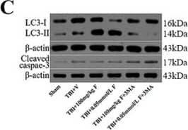 Western Blot: LC3B Antibody - BSA Free [NB600-1384] - Fucoxanthin activated autophagy after TBI.(A) Representative images of immunofluorescence for LC3 surrounding the injured cortex. LC3 punctate dots were observed in the cytoplasm by immunofluorescent staining of LC3 (red). Neuron cells & nuclei are labeled with NeuN (green) & DAPI (blue), respectively. Magnification: 40 x. Scale bar: 50 mm. (B) Mice brain tissues were collected 1 day after TBI in different groups, & the expression of LC3, Beclin-1 & p62 was measured by western blot. Fucoxanthin treatment significantly increased the level of LC3-II & Beclin-1 while decreasing the level of p62 after TBI. (C) 3-MA (400 nM) was injected i.c.v. 30 min before TBI. Mice were then subjected to TBI & treatment of fucoxanthin 30 min after TBI. Pretreatment with 3-MA significantly attenuated fucoxanthin-induced activation of autophagy & suppression of apoptosis & oxidative stress in the ipsilateral cortex. Data are presented as mean ± SEM, n = 6 per group; **p < 0.01, ***p < 0.001 versus sham group; #p < 0.05, ##p < 0.01 versus TBI + vehicle group; &&p < 0.01, &&&p < 0.001 versus TBI + fucoxanthin group.  beta -actin was used as a loading control. Image collected & cropped by CiteAb from the following publication (//pubmed.ncbi.nlm.nih.gov/28429775), licensed under a CC-BY license. Not internally tested by Novus Biologicals.