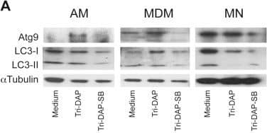 Western Blot: LC3B Antibody - BSA Free [NB600-1384] - After stimulation with the NOD1 ligand, macrophages increased their expression of autophagy proteins Atg9, LC3 & IRGM. Alveolar macrophages (AMs), monocyte-derived macrophages (MDMs) & monocytes (MNs) were incubated in the presence of 5 μg/ml of Tri-DAP for 24 h. Cells were pre-incubated with Rip2/p38 inhibitor SB203580 (SB) for 30 min prior to Tri-DAP stimulation to block NOD1-mediated responses, as indicated. Atg9 & LC3 proteins were measured in the cytosolic fractions by western blot analysis (A). The fold increases relative to the unstimulated cells were calculated after being normalized to tubulin, mean ± SE is depicted, n = 3 (B, C). The up-regulation of IRGM gene expression was assessed after specific ligand recognition by quantitative PCR using the Taqman system &  delta  delta CT method for relative quantification. The fold changes in gene expression relative to the unstimulated cells of at least 6 subjects are depicted; bold lines indicate medians, *p < 0.05 (D). IRGM protein was measured in the cytosolic fractions of three subjects by western blot, & the fold increases relative to the unstimulated cells are indicated after being normalized to tubulin; mean ± SE is depicted, n = 3 (E, F). Image collected & cropped by CiteAb from the following publication (//pubmed.ncbi.nlm.nih.gov/25253572), licensed under a CC-BY license. Not internally tested by Novus Biologicals.