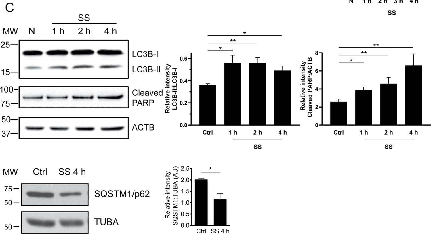 Western Blot: LC3B Antibody - BSA Free [NB600-1384] - Serum starvation induces autophagy & apoptosis in endothelial cells.A Evaluation by Hoechst 33342 & propidium iodide (HO/PI) staining of apoptosis & necrosis in HUVECs exposed to normal medium (N) or serum-starved (SS) for 4 h. P values obtained by unpaired t test. n = 10 for each condition. Scale bar = 25 μm. B Quantification of caspase-3 activity in HUVECs exposed to N or SS HUVECs for 1, 2, 3, & 4 h. P values obtained by one-way ANOVA. n = 4 for each condition. C Immunoblot & densitometric analysis of PARP, LC3, & SQSTM1/p62 in HUVECs exposed to N or SS for 1, 2, or 4 h.  beta -actin (ACTB) was used as a loading control. P values obtained by unpaired t test (*P < 0.05; **P < 0.01; ***P < 0.001). n = 3 for each condition. All values are expressed as the mean ± SEM. Image collected & cropped by CiteAb from the following publication (//pubmed.ncbi.nlm.nih.gov/35149669), licensed under a CC-BY license. Not internally tested by Novus Biologicals.
