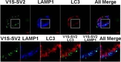 Immunocytochemistry/ Immunofluorescence: LC3B Antibody - BSA Free [NB600-1384] - In vitro  alpha S seeds induce endo-lysosome-free & endo-lysosome-associated  alpha S inclusions in H4/V1S-SV2 cells. (a) Gel analysis of in vitro prepared  alpha S seeds. Recombinant  alpha S solution subjected to 7 days of shaking was ultracentrifuged (110,000 × g, 20 min), & the resultant supernatant & pellet were resolved by SDS-PAGE & western blotting with anti-alpha S antibody (Synuclein-1, 610787, BD Biosciences). A second aliquot without shaking was included as a control. (b) Electron micrographs of  alpha S seeds before & after sonication. Scale bar: 100 nm. Different  alpha S polymorphs are shown in close-ups. (c) H4/V1S-SV2 cells treated with sonicated  alpha S seeds for 2 days were subjected to immunocytochemistry with primary antibody against LAMP1 followed by DAPI counterstain to demonstrate the association between endo-lysosomes & seeded  alpha S inclusions. The bottom two rows are magnified images of frames A & B in the second row. Empty triangles & solid arrowheads denote the endo-lysosome-free & endo-lysosome-associated  alpha S inclusions, respectively. Scale bar: 10 µm (top two rows) & 5 µm (bottom two rows). (d) The treated cells were further subjected to immunocytochemical staining of LAMP1 (Alexa fluor 405) & LC3 (Alexa fluor 568) to demonstrate the association between autophagosomes, endo-lysosomes, & seeded  alpha S inclusions. Scale bar: 5 µm (top row) & 2 µm (bottom row). Image collected & cropped by CiteAb from the following publication (//www.nature.com/articles/s41598-017-08149-w), licensed under a CC-BY license. Not internally tested by Novus Biologicals.