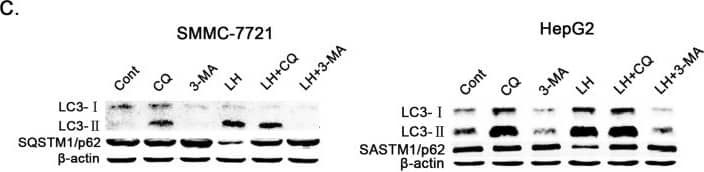 Western Blot: LC3B Antibody - BSA Free [NB600-1384] - Autophagy was induced under conditions of LH & inhibited by CQ & 3-MA in HCC cells.(A–C). SMMC-7721 & HepG2 cells were directly incubated under normal or LH conditions for 8 h or incubated under LH conditions in the presence or absence of CQ or 3-MA for 8 h. (A). The cells were transfected with GFP-tagged LC3 & observed with fluorescence microscopy. Arrows show the punctate GFP-LC3 fluorescence in the cytoplasm. (B). The number of punctate GFP-LC3 in each SMMC-7721 or HepG2 cell was counted, & at least 100 cells were included for each group. The data represent the mean ± SD based on three independent experiments. **p < 0.01. (C). The whole-cell lysates were subjected to western blot analysis as described in the ‘Materials & methods'section. The experiments were repeated at least three times. Image collected & cropped by CiteAb from the following publication (//www.nature.com/articles/srep05382), licensed under a CC-BY license. Not internally tested by Novus Biologicals.