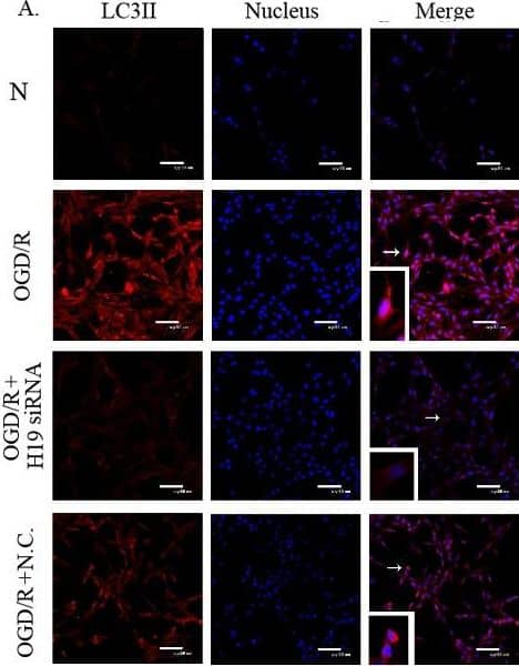 Immunocytochemistry/ Immunofluorescence: LC3B Antibody - BSA Free [NB600-1384] - The effect of H19 siRNA on autophagy in OGD/R model. A) Immunofluorescence of LC3II in different conditions. B) Immunofluorescence of Beclin1 in different conditions. C) Immunofluorescence of P62 in different conditions. D) The change of lncRNA H19 expression level induced by H19 siRNA. E. Western blot of LC3II, LC3I, Beclin1, & P62 in different groups. F, G, & H) Statistical analysis of the expression of LC3II, Beclin1 & P62, respectively. N, normal group; OGD/R, OGD 8 hr & reperfusion 24 hr; OGD/R + H19 siRNA & OGD/R + N.C, transfecting the cells with H19 siRNA & normal control siRNA, respectively, before OGD/R treatment. Bar represents the mean value ± SD. *p<0.05 vs. normal group, #p<0.05 vs. OGD/R group, &p<0.05 vs. OGD/R + H19 siRNA group. White arrows indicate the co-localized positive cells. Image collected & cropped by CiteAb from the following publication (//www.aginganddisease.org/EN/10.14336/AD.2016.0530), licensed under a CC-BY license. Not internally tested by Novus Biologicals.