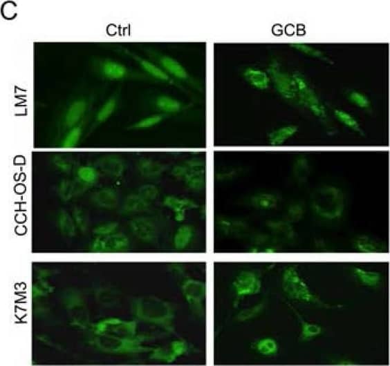 Immunocytochemistry/ Immunofluorescence: LC3B Antibody - BSA Free [NB600-1384] - Treatment with gemcitabine (GCB) induces autophagy in osteosarcoma cellsA. Following 48 hours of treatment with 1μM GCB, LM7, CCH-OS-D, & K7M3 cells were stained with the lysosomotropic agent acridine orange (1 μg/ml) for 15 minutes & then visualized under a confocal microscope. Treatment with GCB led to the formation of acidic vesicular organelles (AVOs –red/orange), as shown in the representative images. B. Flow cytometry was used to measure & quantify AVO formation in untreated (left) & treated (right) osteosarcoma cells. C. Cells were treated with 1μM GCB for 48 hours, & after fixation, cells were stained with anti-LC3 antibody & analyzed by fluorescence confocal microscopy. GCB increases the number of green punctae in the treated group as compared to the untreated. D. Expression of BECN, LC3, & p62 was analyzed using Western blot analysis. Cells were treated with GCB for 48 hours, lysed & extracted protein was analyzed using specific antibodies.  beta -actin was used as a loading control. Autophagy induction is demonstrated by an increase in the conversion of LC3I to LC3II, BECN expression & a decrease in p62 expression in the treated group as compared with the untreated. E. Treatment of OS cells with GCB (1μM, 48 hours), led to an increase in the formation of autophagic vacuoles (shown with red arrows) measured by transmission electron microscopy. Image collected & cropped by CiteAb from the following publication (//www.oncotarget.com/lookup/doi/10.18632/oncotarget.20308), licensed under a CC-BY license. Not internally tested by Novus Biologicals.