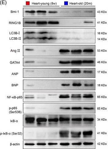 Western Blot: LC3B Antibody - BSA Free [NB600-1384] - Bmi‐1‐RING1B & autophagy are negatively related to SA‐PCH. (A) Kyoto Encyclopedia of Genes & Genomes (KEGG) analysis was conducted using differentially expressed genes (DEGs) in young (14‐week‐old) & old (18‐month‐old) mouse hearts. (B) Gene set enrichment analysis (GSEA) on autophagy signal pathway & ubiquitin‐mediated proteolysis. (C) Genes Correlation analysis using 12‐ & 18‐ month mouse hearts RNAseq count data. (D) Gene Ontology (GO) analysis & GSEA were processed using genes that were highly related to Bmi‐1. (E) Western blots of cardiac extracts of WT young (8‐week‐old) or aging (20‐month‐old) mice showing Bmi‐1, RING1B, LC3BII, Ang II, GATA4, ANP, BNP, NF‐ kappa B‐p65 & p‐p65 (Ser536), I kappa B‐ alpha  & p‐I kappa B‐ alpha  (Ser32);  beta ‐actin was the loading control. (F) Protein levels relative to  beta ‐actin were assessed by densitometric analysis. Six mice per group were used for experiments. Values are mean ± SEM of six determinations per group, **p < .01, ***p < .001 compared with the WT young mice, unpaired t‐test for bar graphs Image collected & cropped by CiteAb from the following publication (//pubmed.ncbi.nlm.nih.gov/35390228), licensed under a CC-BY license. Not internally tested by Novus Biologicals.