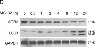 Western Blot: LC3B Antibody - BSA Free [NB600-1384] - Activation of autophagy by MG132 is associated with AGR2 decline. a The expression change of AGR2 in A549 cells was estimated by western blotting analysis. A549 cells were incubated with CHX (2 μg/ml) for 2 h prior to MG132 treatment. GAPDH served as a loading control. b AGR2 ubiquitination was detected by immunoprecipitation with anti-AGR2 antibody & immunoblotting with anti-Ub antibody. Similar results were obtained with three independent experiments. c Immunofluorescence microscopy for analysis of punctate pattern of LC3 localization in A549 cells transiently transfected with the GFP-LC3-vector for 24 h & treated with MG132 for additional 12 or 24 h, & LC3 punctate (right panel) was calculated in A549 cells. **p < 0.01 compared with the control. Scale bar = 20 μm. d The levels of AGR2 & LC3B were measured by western blotting with MG132 treatment at indicated time. e Analysis of LC3B & AGR2 accumulation in A549 cells by fluorescent staining. Scale bar = 10 μm Image collected & cropped by CiteAb from the following publication (//pubmed.ncbi.nlm.nih.gov/30647455), licensed under a CC-BY license. Not internally tested by Novus Biologicals.