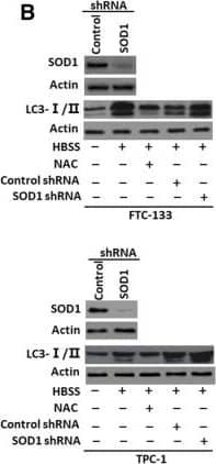 Western Blot: LC3B Antibody - BSA Free [NB600-1384] - ROS was sufficient for inducing HMGB1 translocation & enhancing autophagy (a) FTC-133/TPC-1 cells were pretreated with the antioxidant (NAC, 2 mM) for 1 h & then starved by HBSS for 3 h. ROS production was assessed by measuring the fluorescent intensity of DCF on a fluorescent plate reader. Incremental production of ROS was expressed as a percentage of control (n = 3, *P < 0.01, **P < 0.01). UT, untreated group; (b) Antioxidant & SOD1 RNAi regulated starvation-induced autophagy as measured by LC3-II expression. FTC-133/TPC-1 cells were pretreated with NAC (2 mM) for 1 h or SOD1 RNAi for 48 h, & then starved by HBSS for 3 h. LC3-I/II level was assayed by Western blot. (c) Antioxidant & SOD1 RNAi regulated starvation-induced HMGB1 translocation. FTC-133/TPC-1 cells were pretreated with NAC (2 mM) for 1 h or SOD1 RNAi for 48 h, & then starved by HBSS for 3 h. & the expression of nuclear/cytosolic HMGB1 was assayed by Western blot. Fibrillarin was a nuclear fraction control & tubulin a cytoplasmic fraction control Image collected & cropped by CiteAb from the following publication (//pubmed.ncbi.nlm.nih.gov/31331356), licensed under a CC-BY license. Not internally tested by Novus Biologicals.